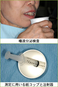 写真：唾液分泌検査、測定に用いる紙コップと注射器
