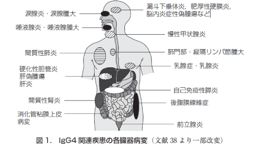 図１．IgG4関連疾患の各臓器病変（文献38より一部改変）